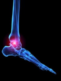Types Of Arthritis That Can Affect The Feet