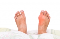 What Is Causing My Painful Bunion?